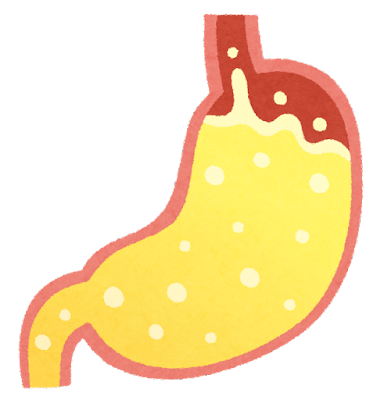胃酸の逆流
